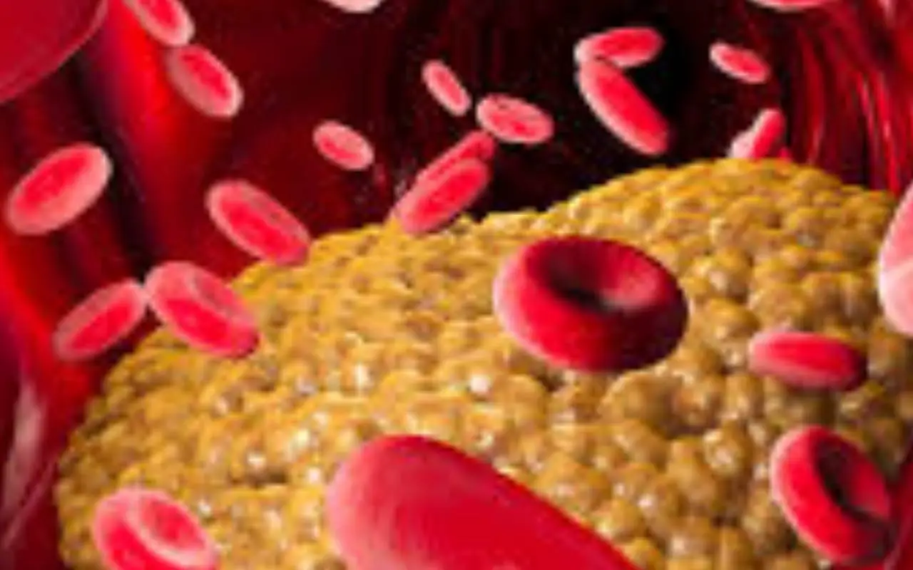 Attenzione a questi fattori: sono le cause silenziose che bloccano la circolazione del sangue