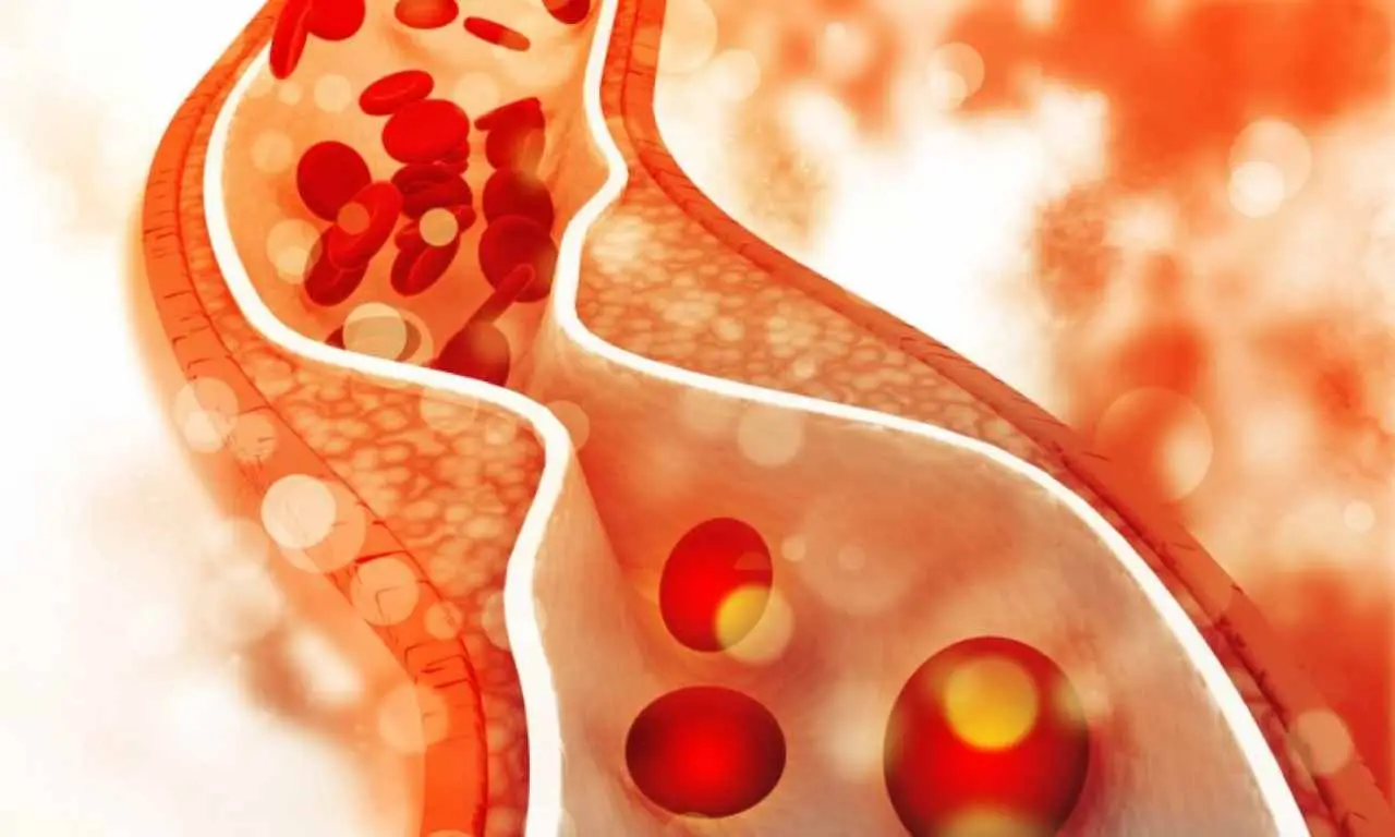 L’abitudine quotidiana che sta silenziosamente bloccando le tue arterie: ecco come prevenirlo